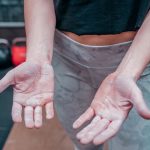 forming a callus